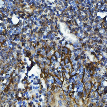 GPCR RDC1/CXCR-7/ACKR3/CXCR Rabbit Polyclonal Antibody