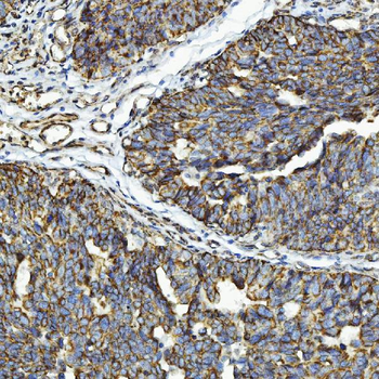 GPCR RDC1/CXCR-7/ACKR3/CXCR Rabbit Polyclonal Antibody