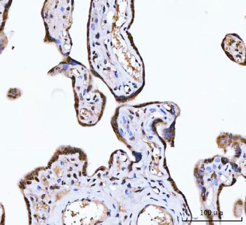 ZMYND8 Rabbit Polyclonal Antibody