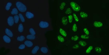 Exportin-5/XPO5 Rabbit Polyclonal Antibody