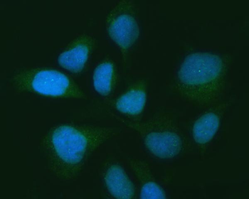 USP16 Rabbit Polyclonal Antibody