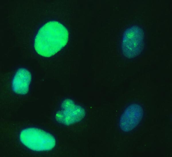 UBE2S Rabbit Polyclonal Antibody