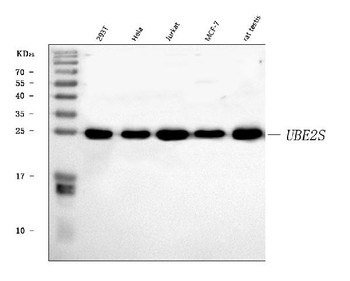 UBE2S Rabbit Polyclonal Antibody