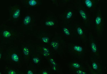 Ubc13/UBE2N Rabbit Polyclonal Antibody
