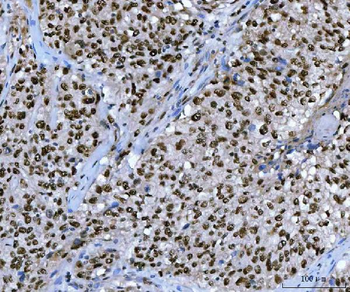 Ubc13/UBE2N Rabbit Polyclonal Antibody