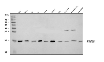 Ubc13/UBE2N Rabbit Polyclonal Antibody