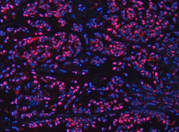 UBC12/UBE2M Rabbit Polyclonal Antibody