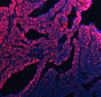 UBC12/UBE2M Rabbit Polyclonal Antibody
