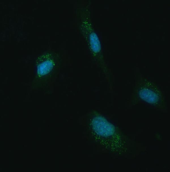 UBC12/UBE2M Rabbit Polyclonal Antibody