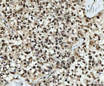 UBC12/UBE2M Rabbit Polyclonal Antibody
