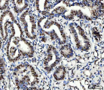 UBC12/UBE2M Rabbit Polyclonal Antibody