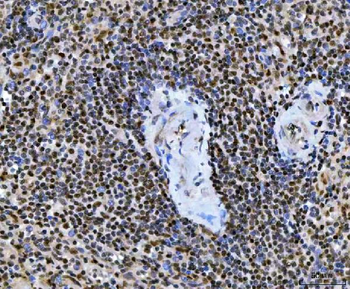 UBC12/UBE2M Rabbit Polyclonal Antibody