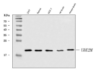 UBC12/UBE2M Rabbit Polyclonal Antibody