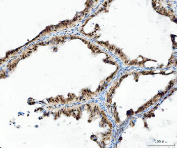 UBA6 Rabbit Polyclonal Antibody