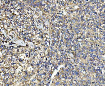 UBA5 Rabbit Polyclonal Antibody