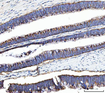 UBA5 Rabbit Polyclonal Antibody