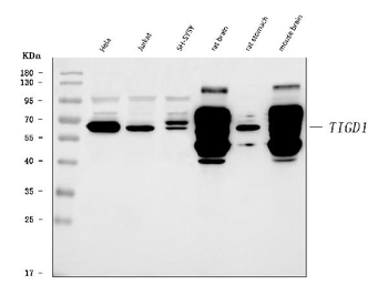 TIGD1 Rabbit Polyclonal Antibody