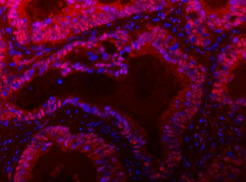 TIGD1 Rabbit Polyclonal Antibody