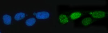 TIGD1 Rabbit Polyclonal Antibody