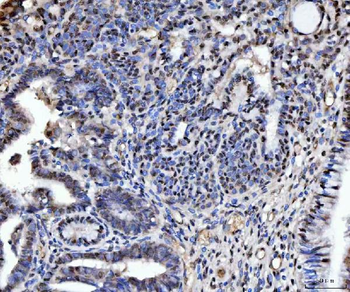 TIGD1 Rabbit Polyclonal Antibody