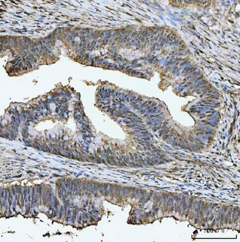 TIGD1 Rabbit Polyclonal Antibody