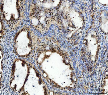 TIGD1 Rabbit Polyclonal Antibody