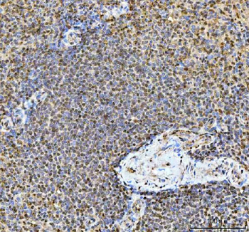 TIGD1 Rabbit Polyclonal Antibody