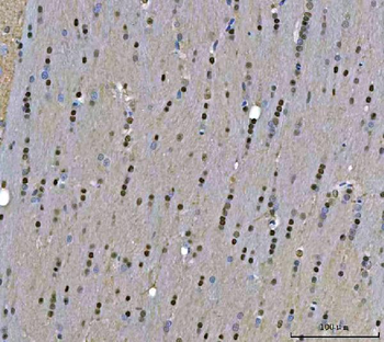 TIGD1 Rabbit Polyclonal Antibody