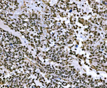 THAP11 Rabbit Polyclonal Antibody
