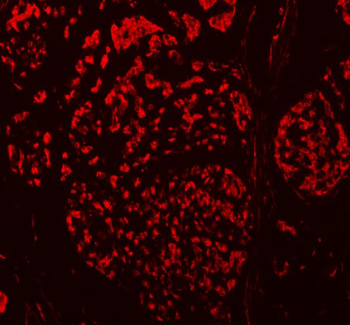 TBX18 Rabbit Polyclonal Antibody
