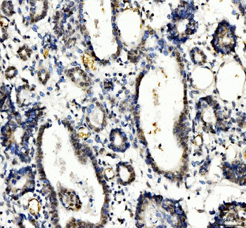 TBX18 Rabbit Polyclonal Antibody