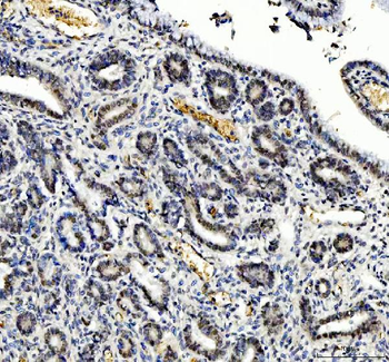 TBX18 Rabbit Polyclonal Antibody