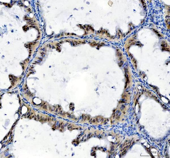 TBX18 Rabbit Polyclonal Antibody