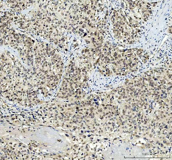 TBX18 Rabbit Polyclonal Antibody