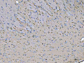 MST3/STK24 Rabbit Polyclonal Antibody