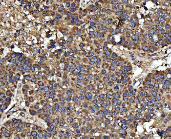 HSD17B7 Rabbit Polyclonal Antibody