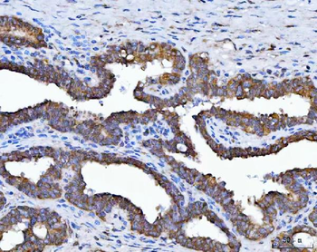 HSD17B7 Rabbit Polyclonal Antibody