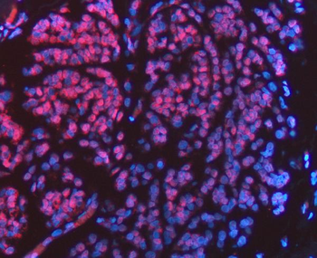 FIP1L1 Rabbit Polyclonal Antibody