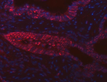 FIP1L1 Rabbit Polyclonal Antibody