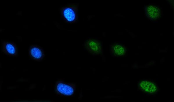 FIP1L1 Rabbit Polyclonal Antibody