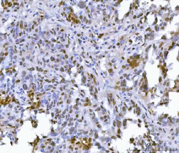 FIP1L1 Rabbit Polyclonal Antibody