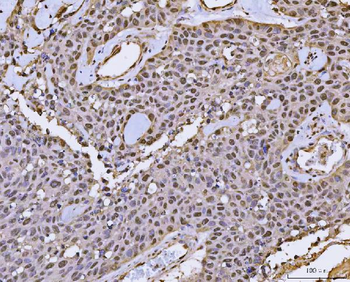 FIP1L1 Rabbit Polyclonal Antibody