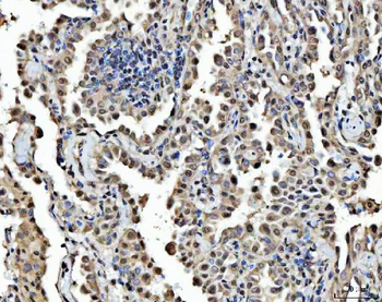 FIP1L1 Rabbit Polyclonal Antibody