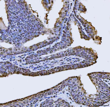 FIP1L1 Rabbit Polyclonal Antibody