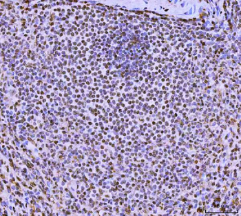 FIP1L1 Rabbit Polyclonal Antibody