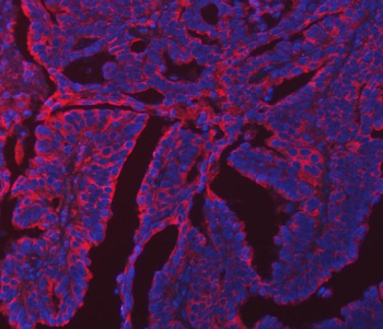 ERP29 Rabbit Polyclonal Antibody