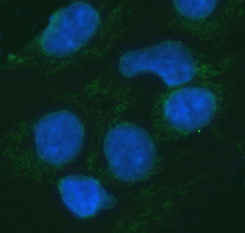ERP29 Rabbit Polyclonal Antibody