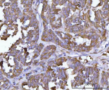ERP29 Rabbit Polyclonal Antibody