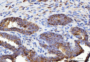 ERP29 Rabbit Polyclonal Antibody