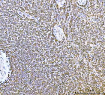 ERP29 Rabbit Polyclonal Antibody